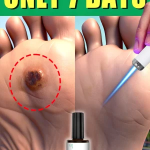 Laser Exfoliating Pen