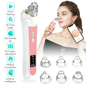 HD Camera Blackhead Remover